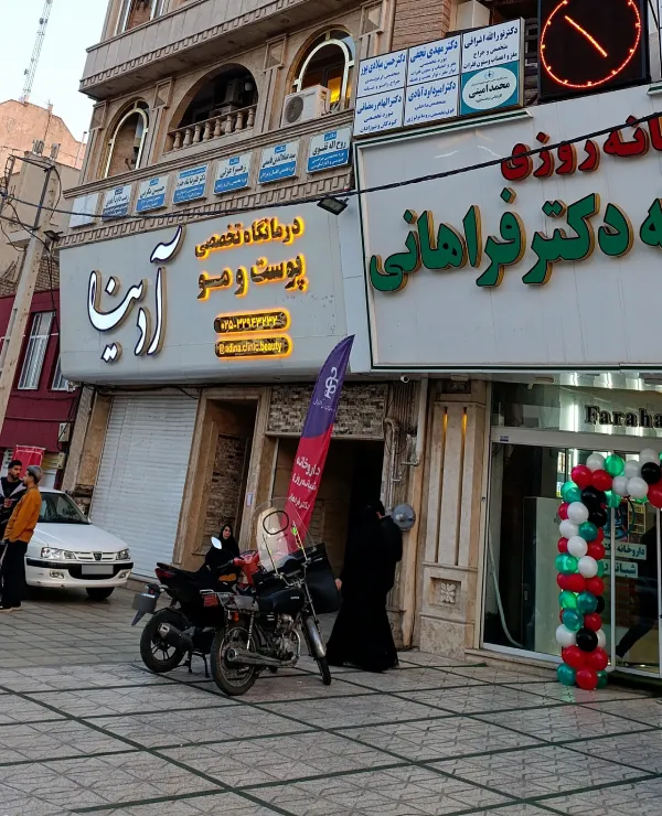 کاشت مو آدینا قم