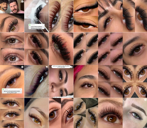 کاشت مژه هدا قم