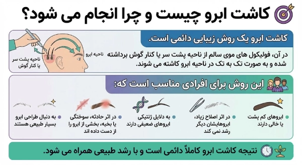 کاشت ابرو چیست
